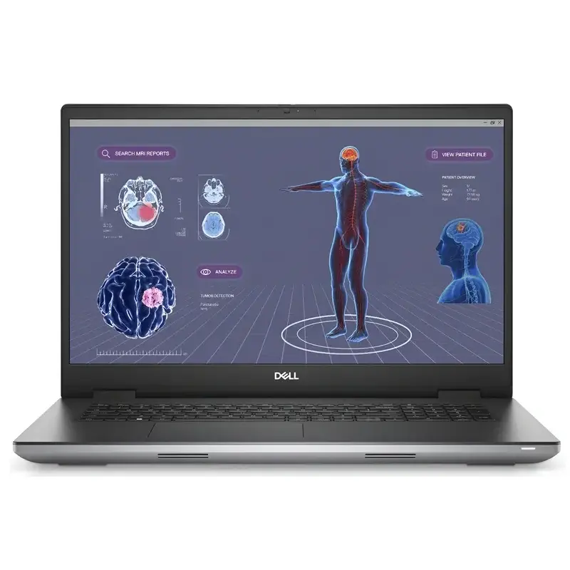 View of Dell Precision 7780 Mobile Workstation